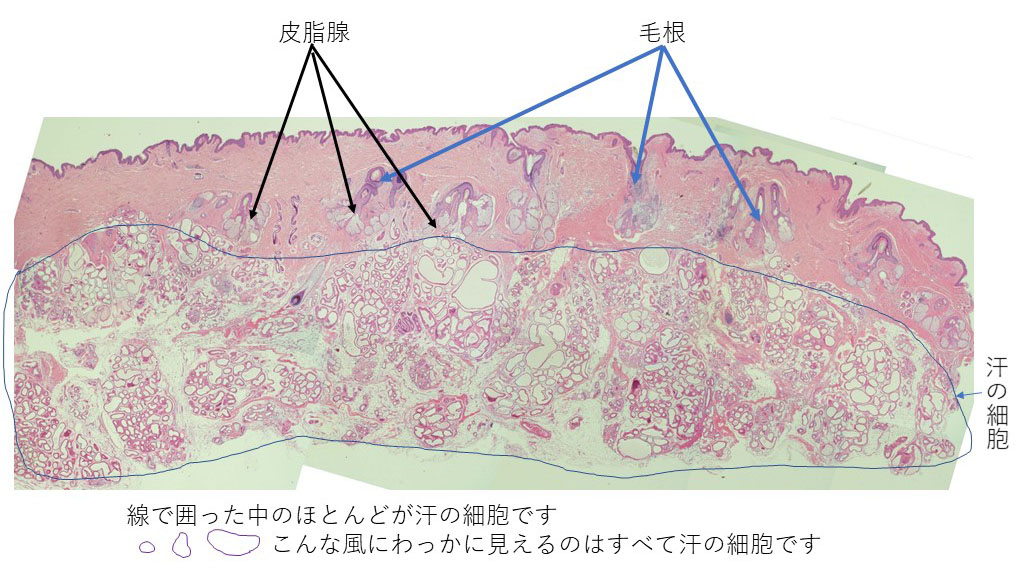 病理