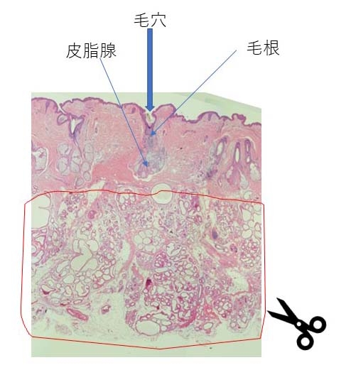 剪除